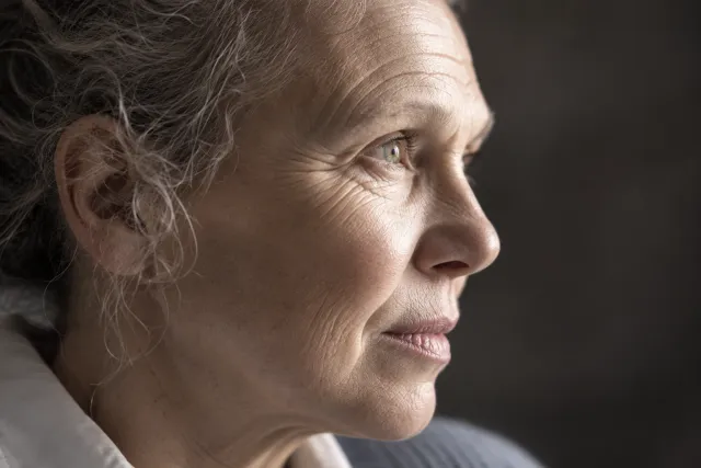 Can a bad facelift be corrected? — Clinic Selnau Zürich